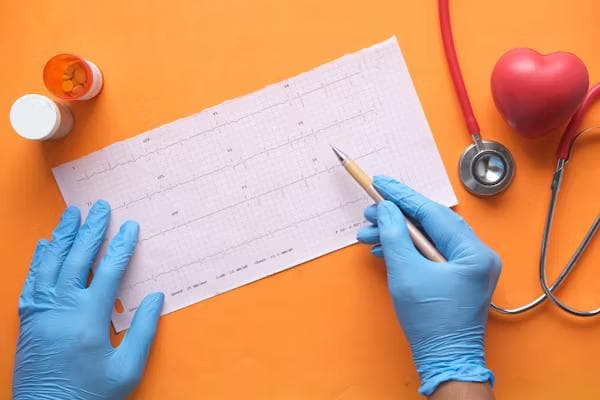electrocardiograma